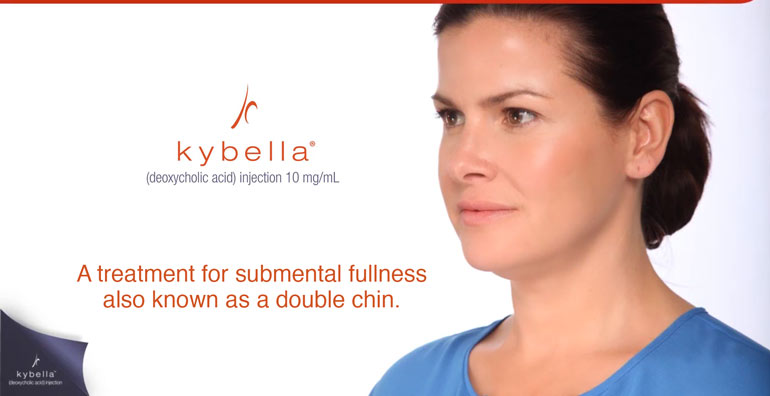 JKybella treatment in Ft Lauderdale -- treats submental fullness aka douuble chin