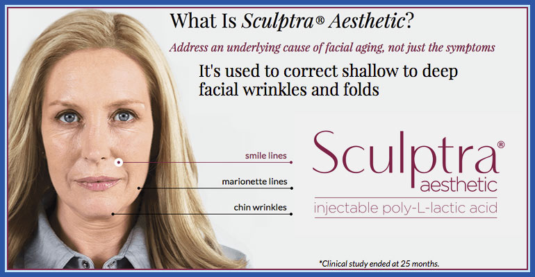 Sculptra in Ft Lauderdale -- correct shallow to deep facial wrinkles and folds